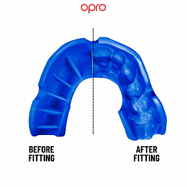 Детская боксерская капа Opro Bronze Blue 1